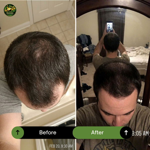 4 Weeks of Use
